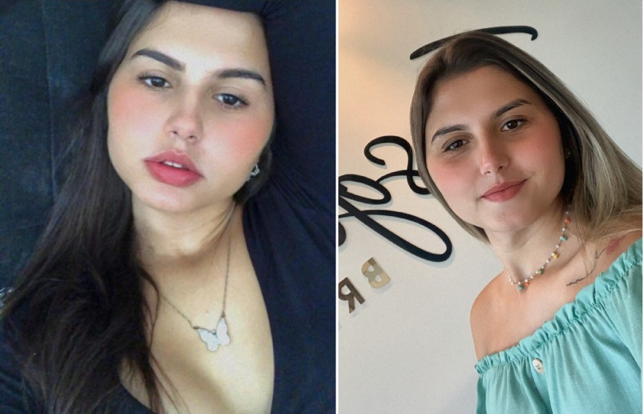 Gemelas trans brasileñas pasan juntas por cirugía de cambio de sexo